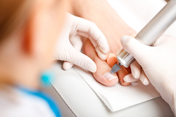 medicinska pedikura rijeka